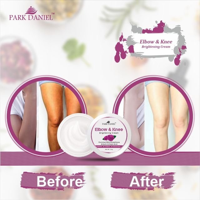 Elbow & Knee Brightening Cream - Image 4