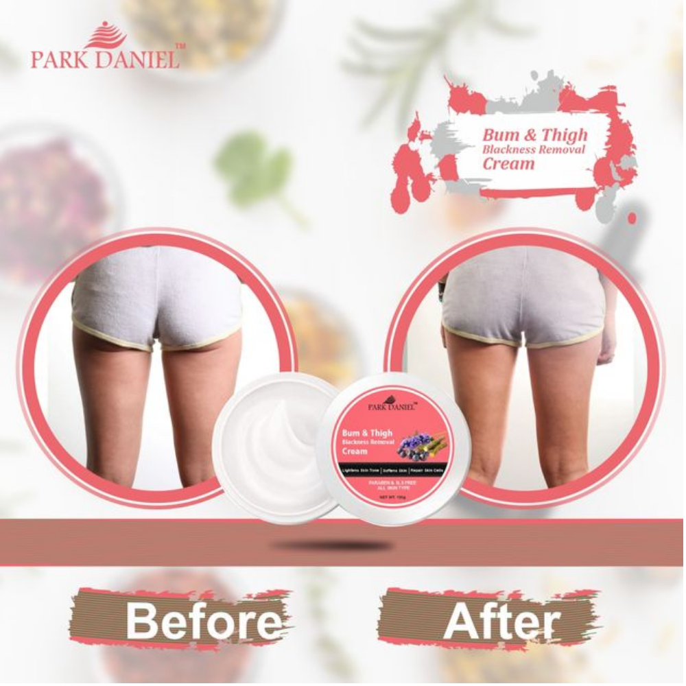 Bum & Thigh Blackness Removal Cream - Image 2
