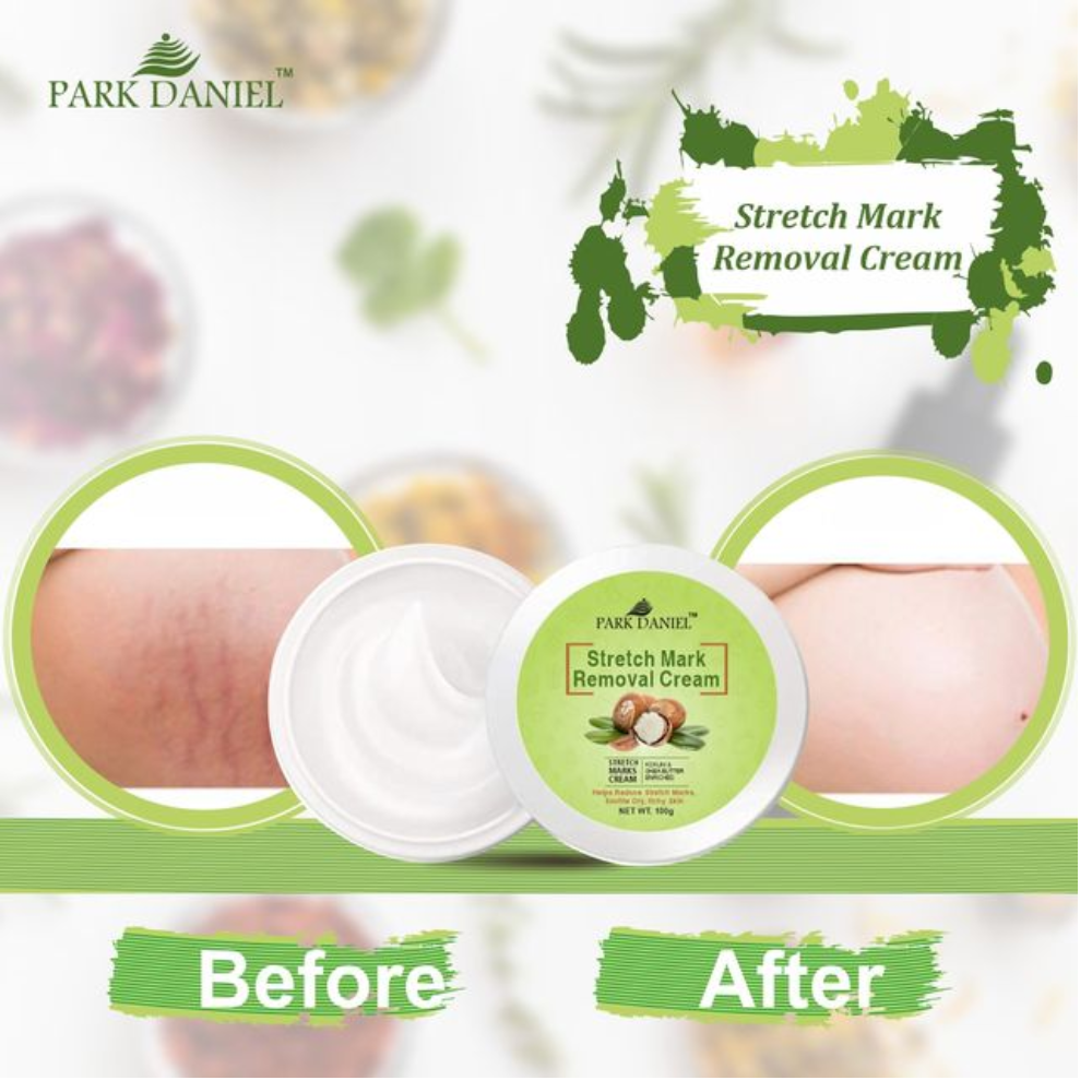 Stretch Marks Removal Cream - Image 2