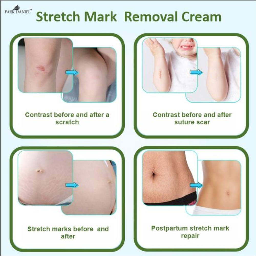 Underarms Whitening Cream - Image 3