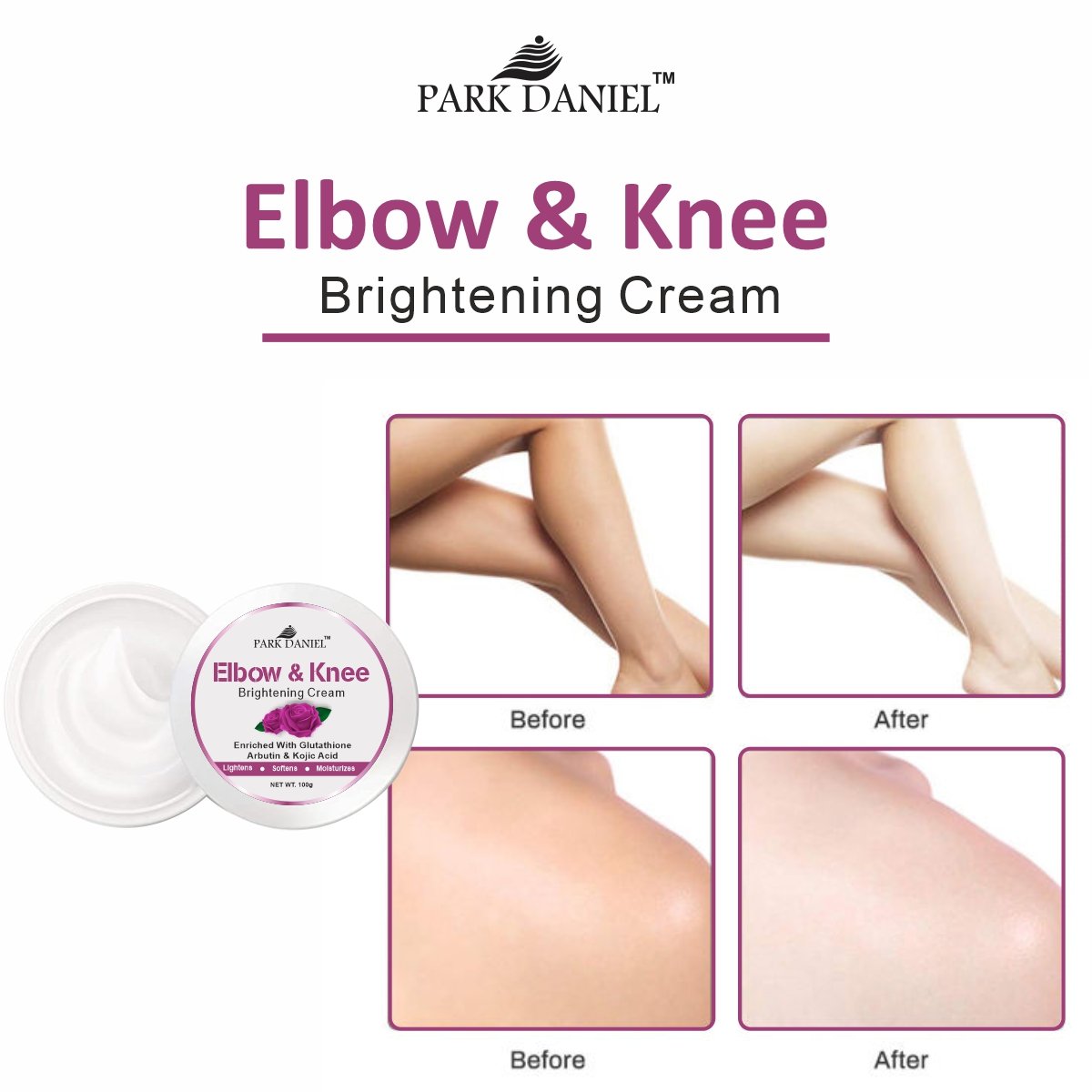 Elbow & Knee Brightening Cream - Image 3