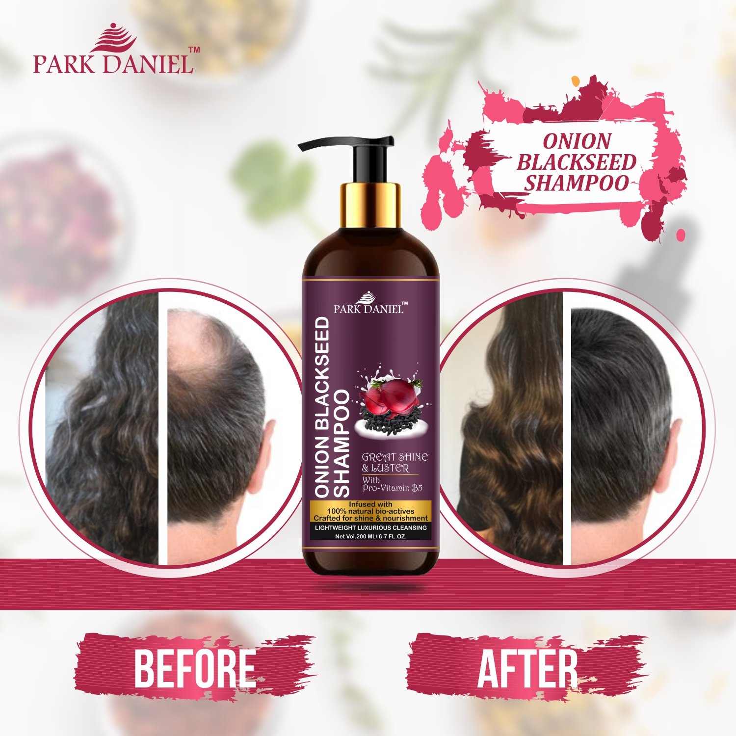 Onion Blackseed Shampoo - Image 2